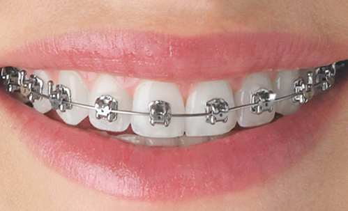Are you in need of orthodontic treatment & what do you look for in an  orthodontist? - My Primary Dental